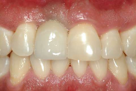 Meadows Dental Care: Dr. Robert S. Radin, DDS